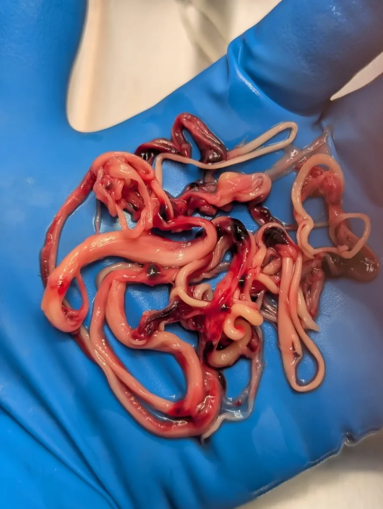 White Fibrous Blood Clot Saga