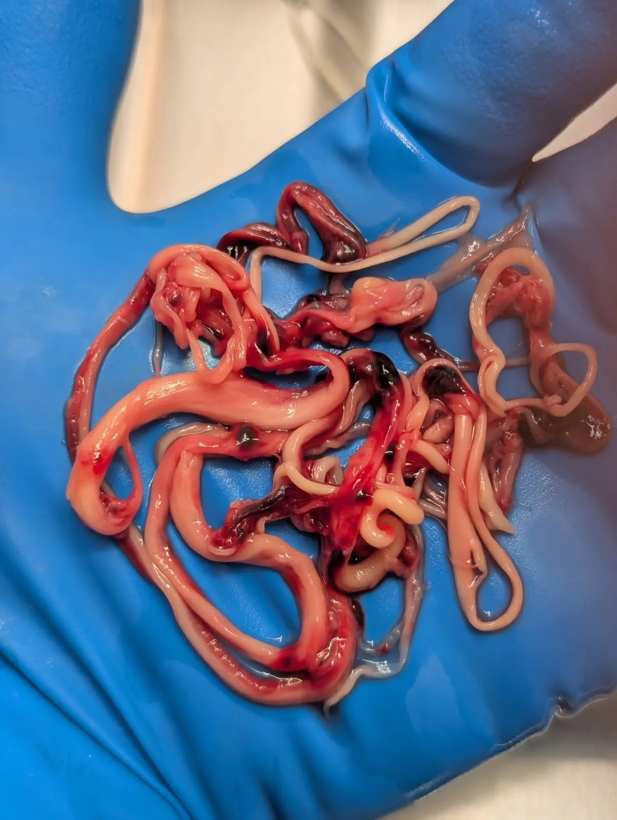 Bloodclots